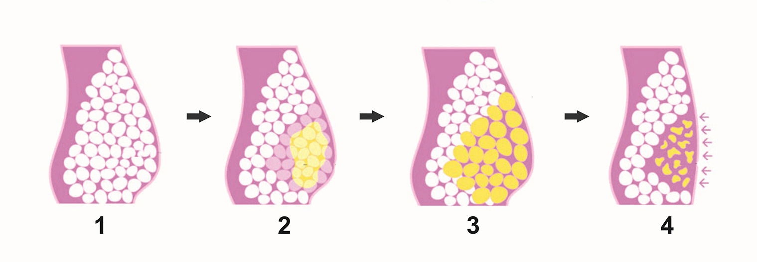 Thuốc giảm cân tác động mỡ trắng